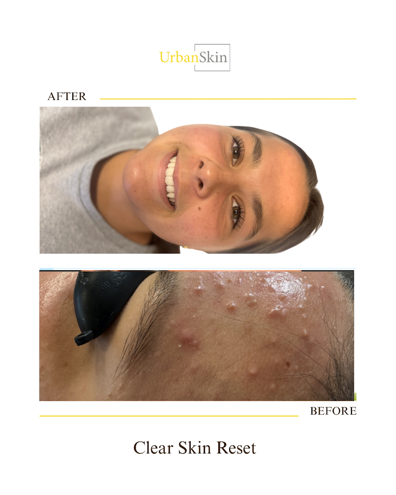 UrbanSkin photo 4