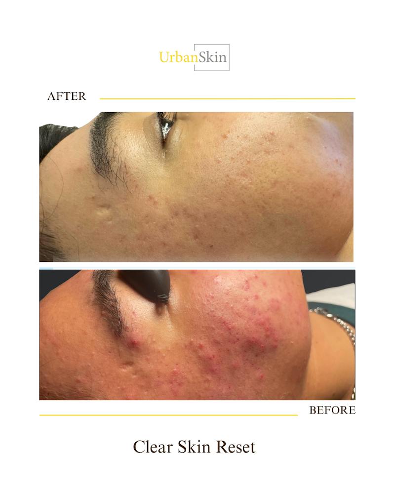 UrbanSkin photo 3