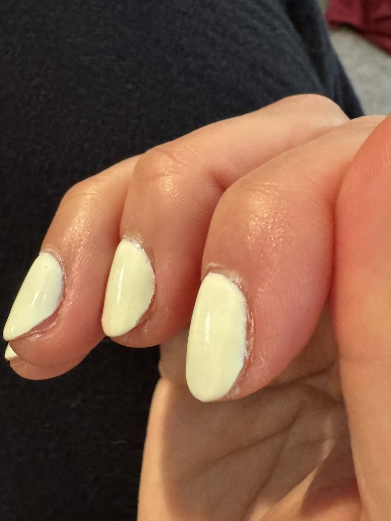 Photo of Fingers and Toes