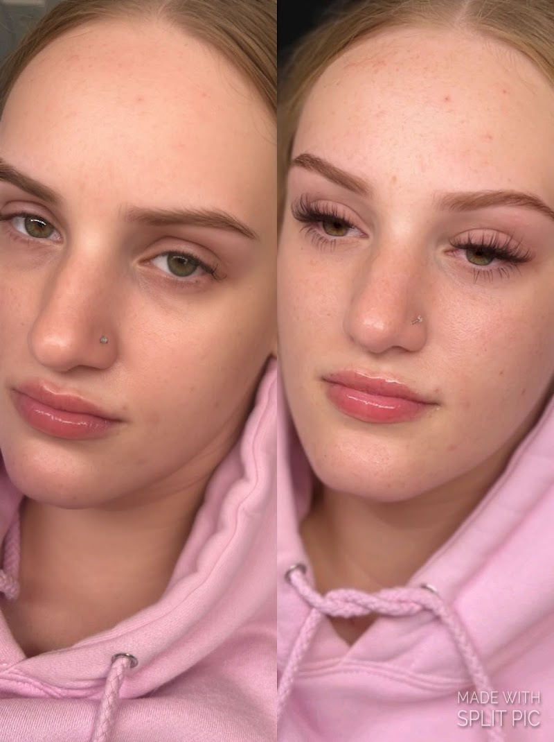 Rawesthetics photo 2