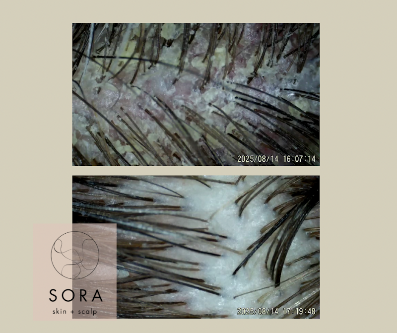 Sora Head Spa photo 4