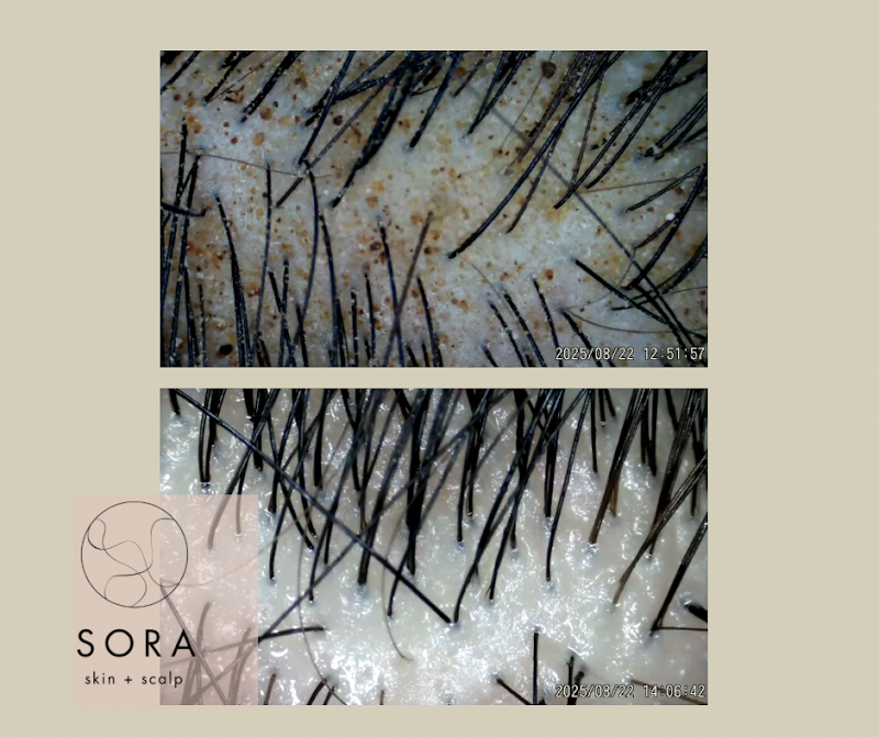 Sora Head Spa photo 3