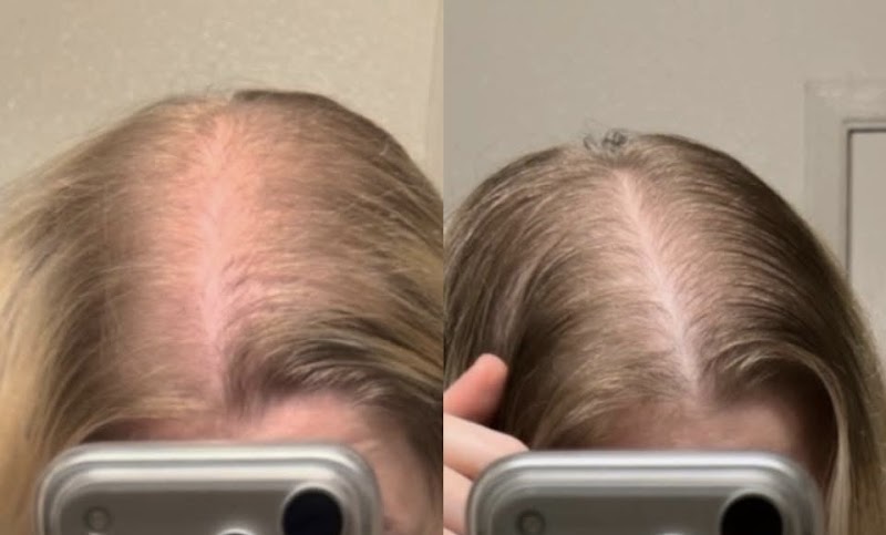HairVive Trichology Clinic photo 2