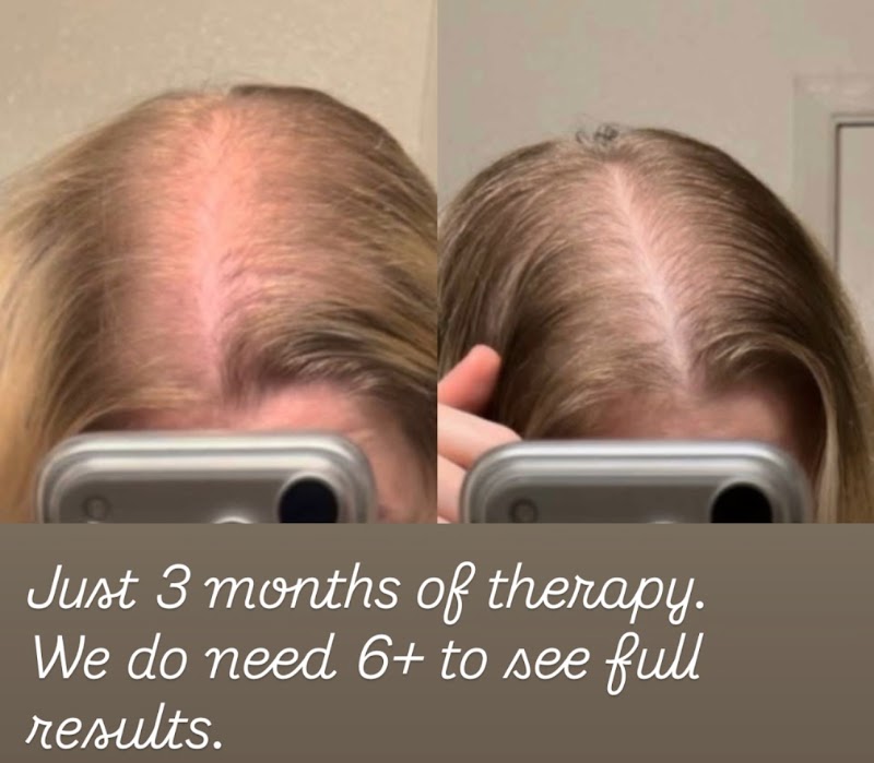 HairVive Trichology Clinic photo 4