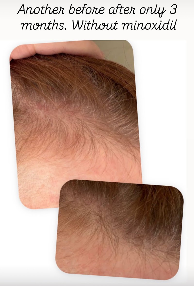 HairVive Trichology Clinic photo 3