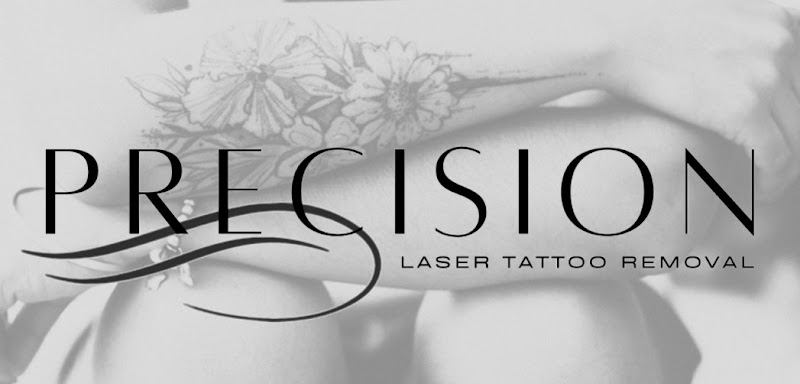 Photo of Precision Laser Tattoo Removal
