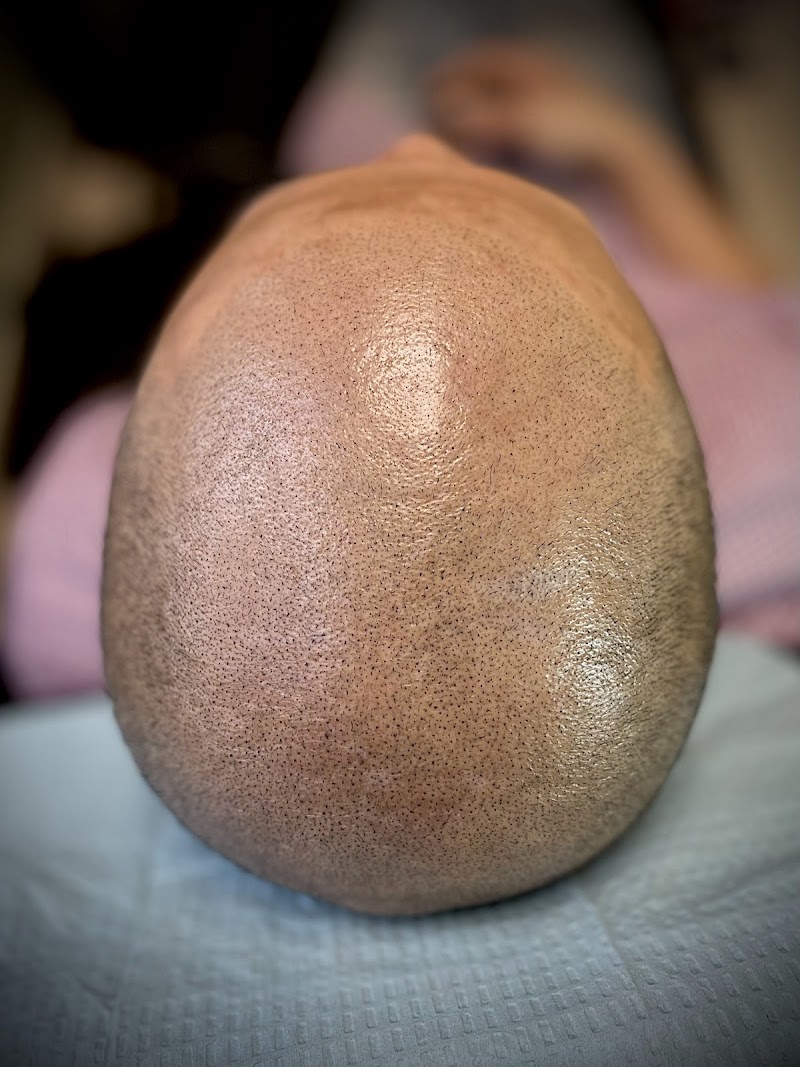 Photo of Envision Microscalp