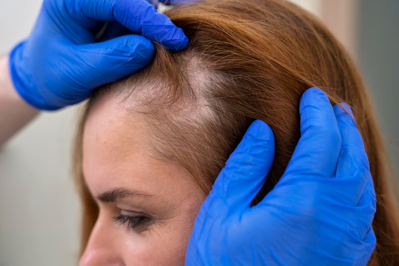 Envision Microscalp photo 2