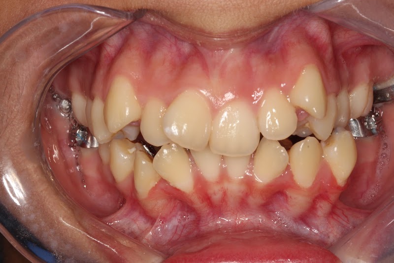 Arbor Dental photo 2