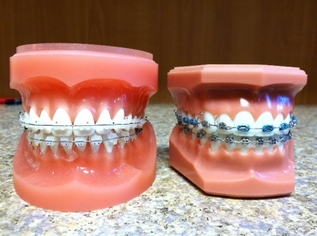 Hooray 4 Teeth photo 2