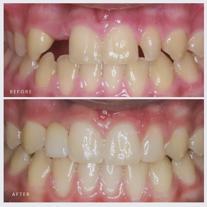 Palo Alto Dentist -Mary Qian Dental Group photo 2