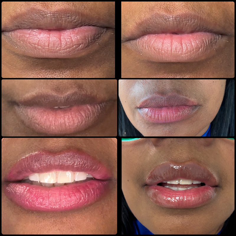 BellaVida Aesthetics & Wellness photo 3