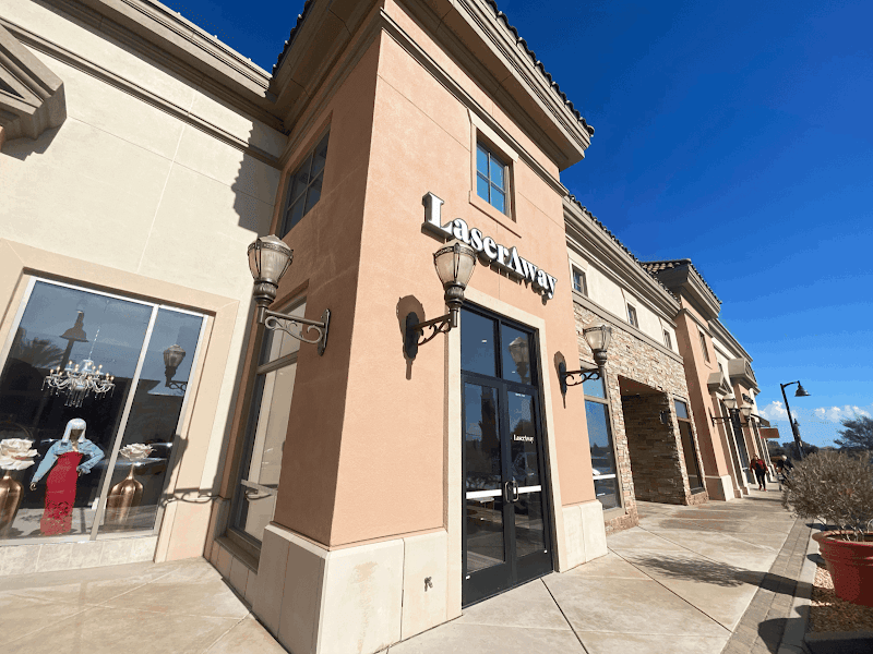 LaserAway Brentwood photo 3