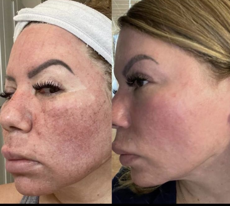 Julieta BeautySkin photo 3