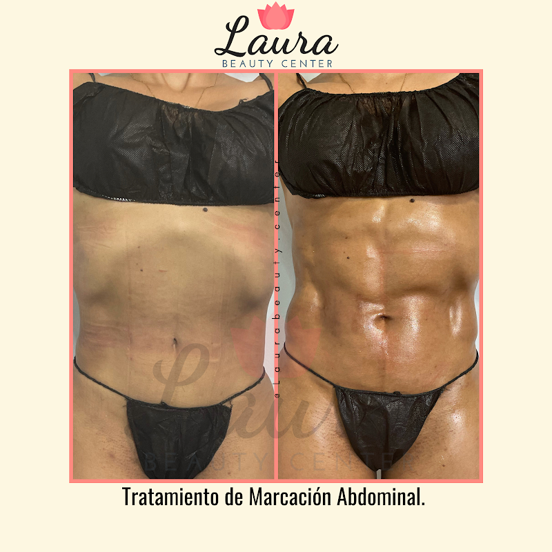 Laura Beauty Center photo 2
