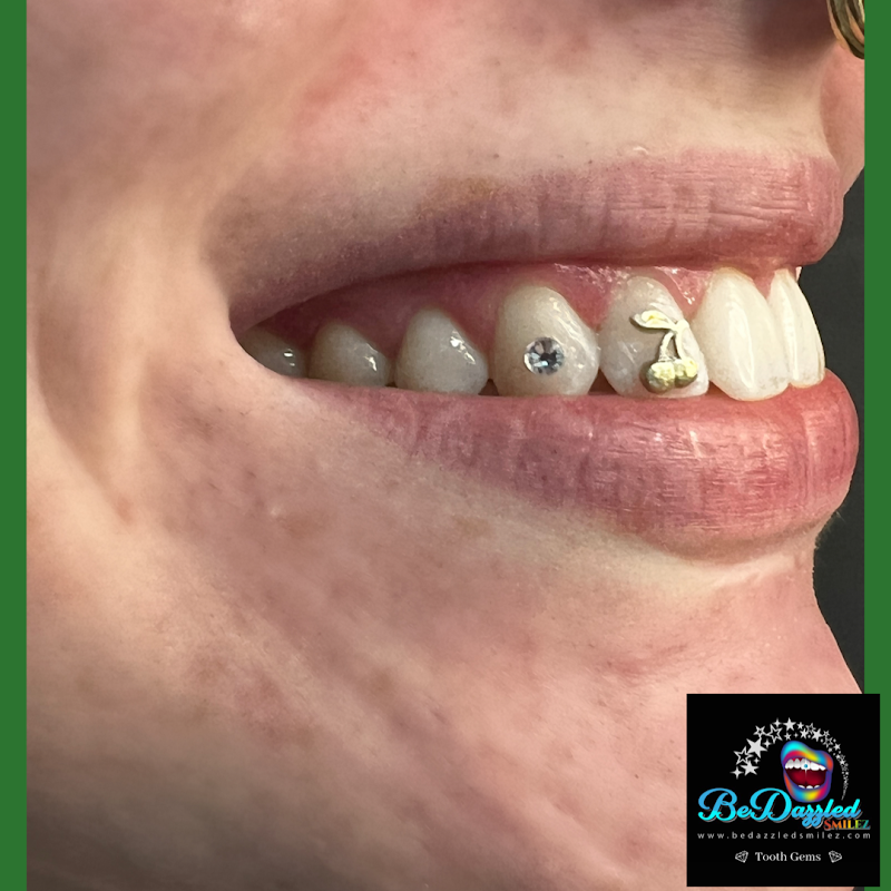 Photo of BeDazzled Smilez