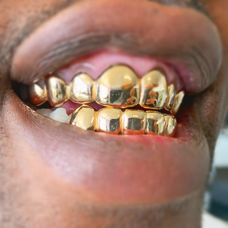 The Plug Jewelry & Grillz Gold Teeth photo 5