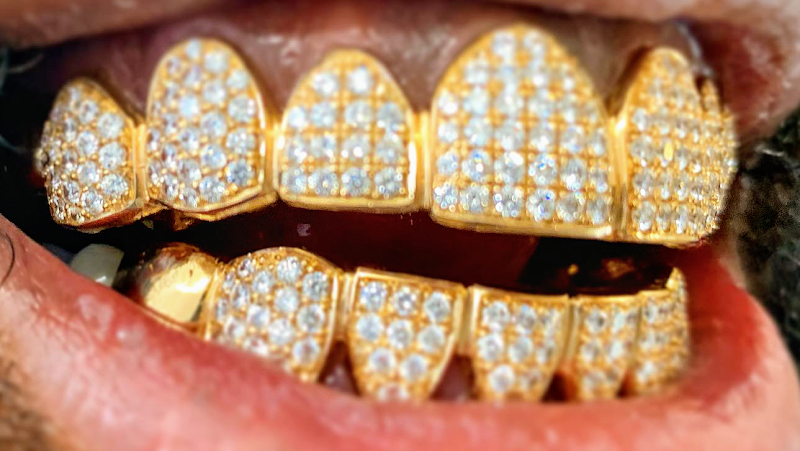 The Plug Jewelry & Grillz Gold Teeth photo 2
