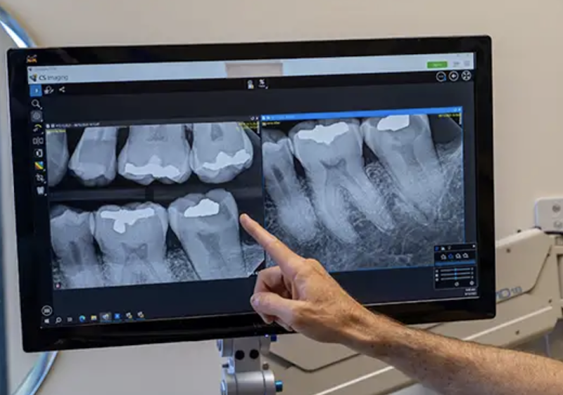 Dental Implant Center at Walnut Creek photo 3