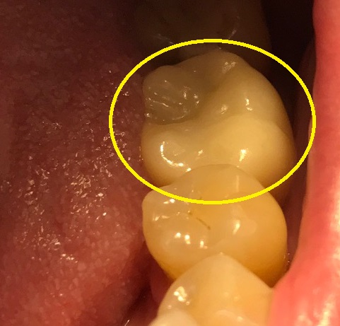Tice Valley Dental: Sean Karimian, D.D.S. photo 5