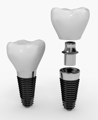 Tice Valley Dental: Sean Karimian, D.D.S. photo 3