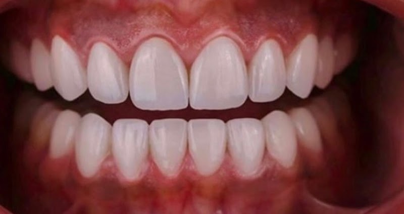 Dr. Tony Chung, DDS photo 4