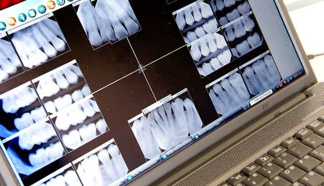 Smile Matters! - Preet Sahota DDS Fremont Dentist photo 5