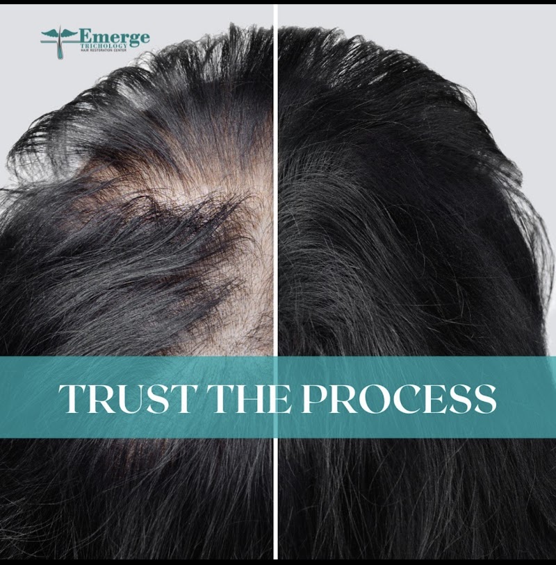 Emerge Trichology Hair Restoration photo 4