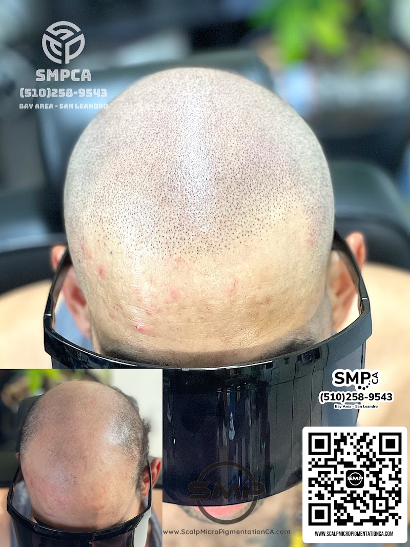 Scalp Micropigmentation CA (SMPCA Academy) photo 4