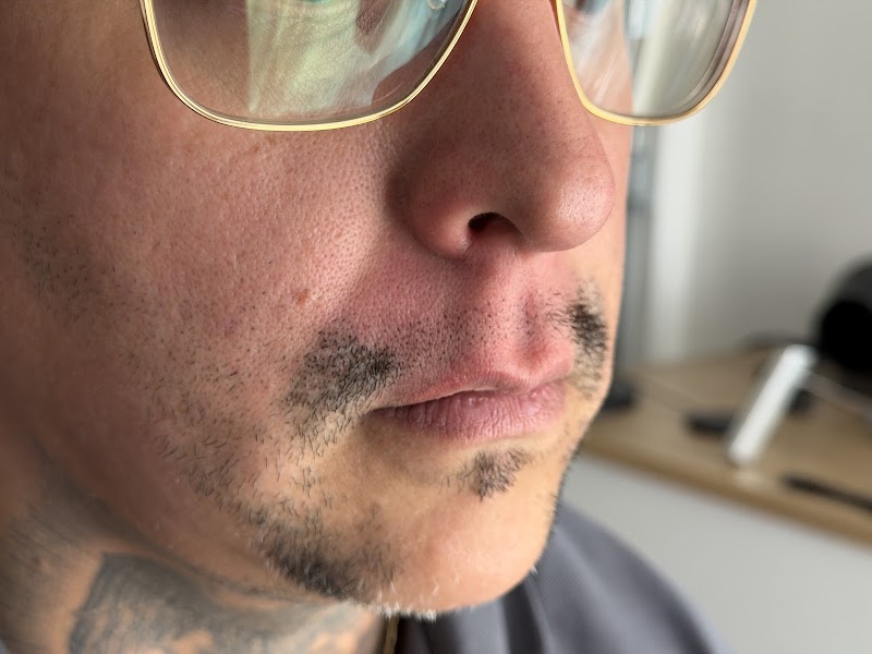 Scalp Micropigmentation CA (SMPCA Academy) photo 5