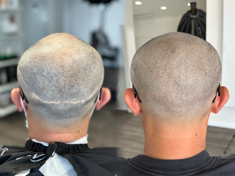 Photo of Scalp Micropigmentation CA (SMPCA Academy)
