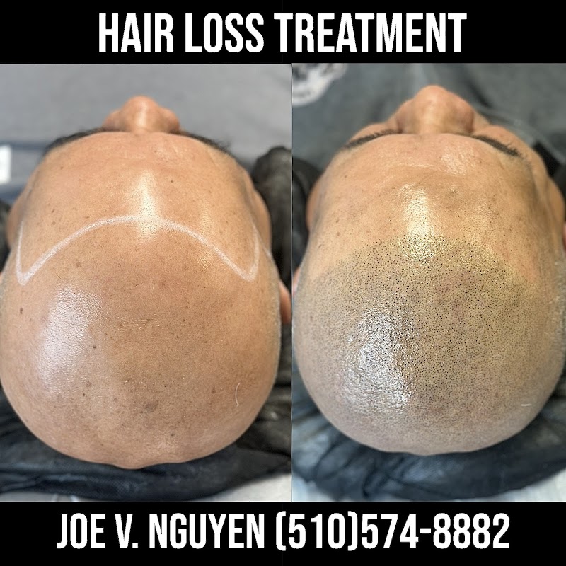 Scalp Micropigmentation CA (SMPCA Academy) photo 2