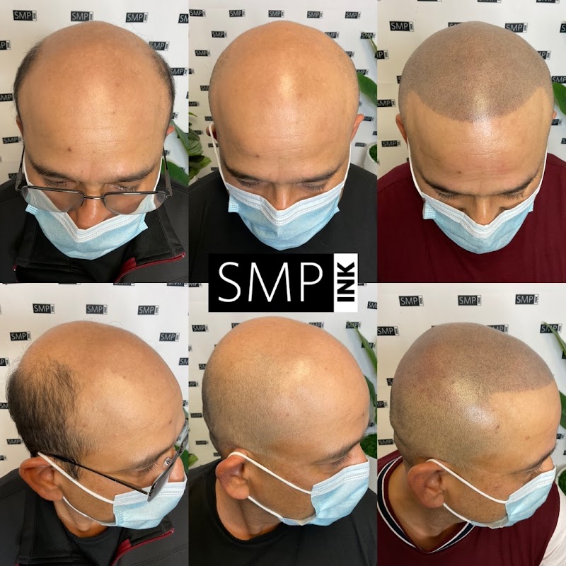 Photo of SMP INK | Scalp Micropigmentation & Training Classes | Microblading & Classes