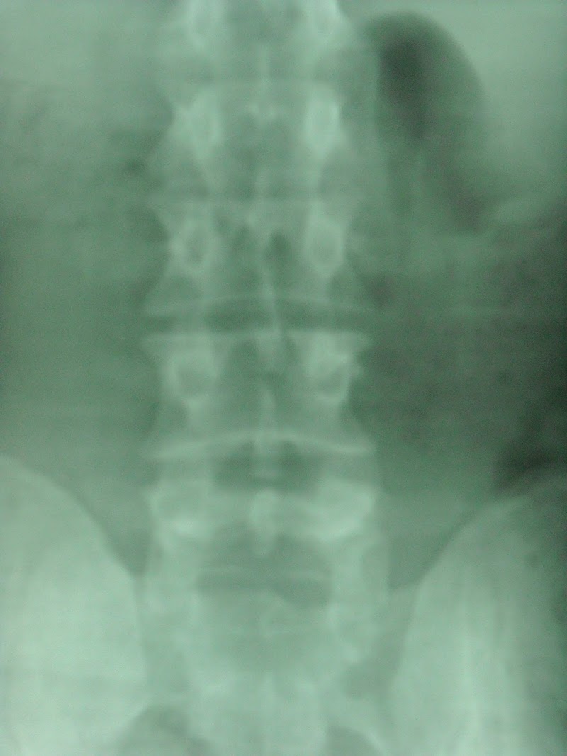 St Helena Chiropractic Center - Daniel W. Hamlin, DC photo 5