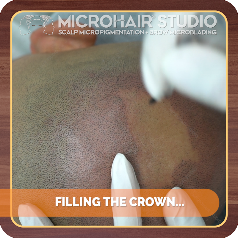MicroHair Studio (Scalp Micropigmentation) photo 3