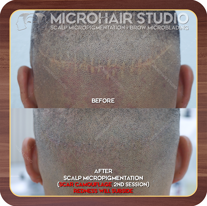 Photo of MicroHair Studio (Scalp Micropigmentation)