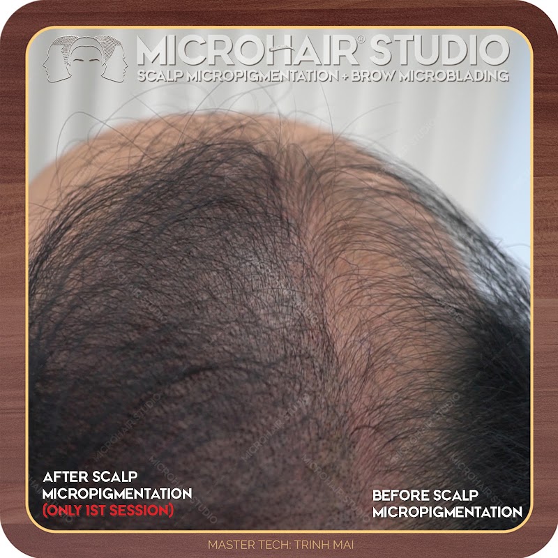 MicroHair Studio (Scalp Micropigmentation) photo 2