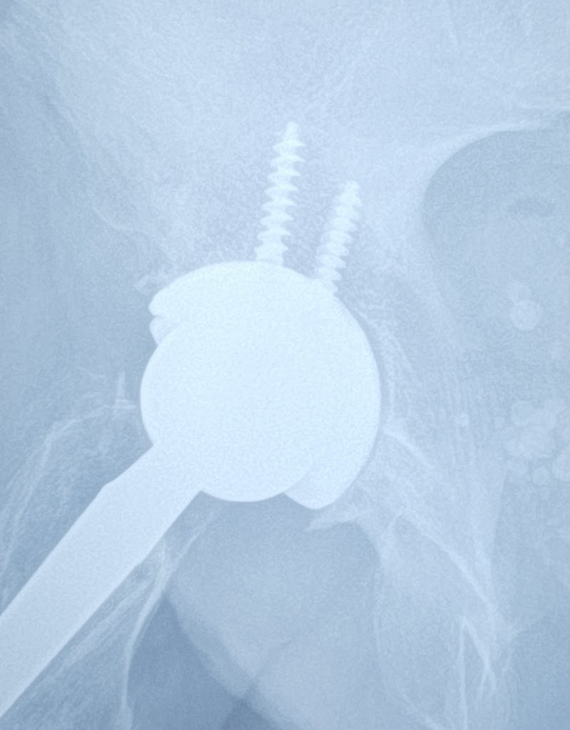 Coon Joint Replacement Institute: Adventist Health St. Helena photo 3