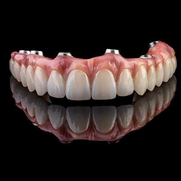 Center for Implant Dentistry photo 5