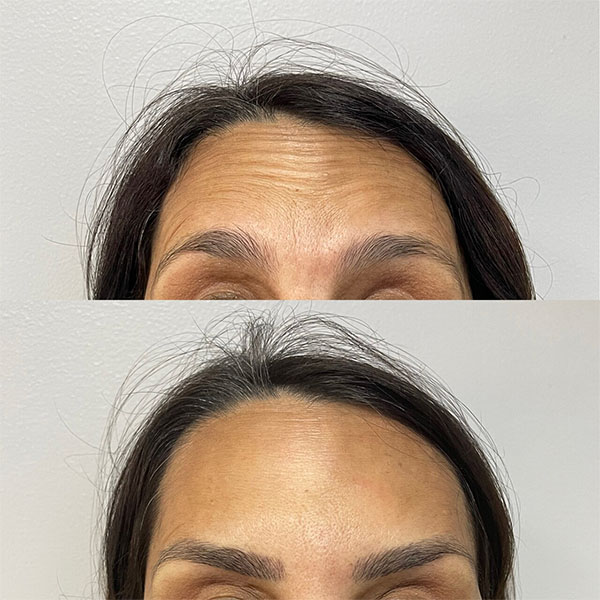 Silicon Valley Aesthetic Dermatology photo 5