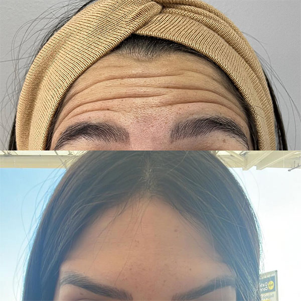 Silicon Valley Aesthetic Dermatology photo 4