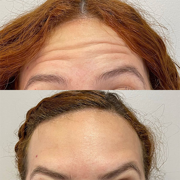 Silicon Valley Aesthetic Dermatology photo 3
