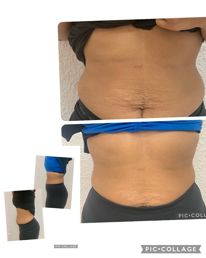 RejuvaNu Medspa and Wellness photo 5