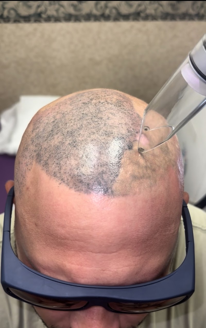 EradiTatt Tattoo Removal of Palm Harbor/Clearwater photo 3