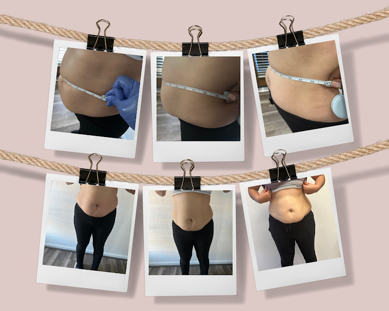 Her Contour & Wellness photo 4