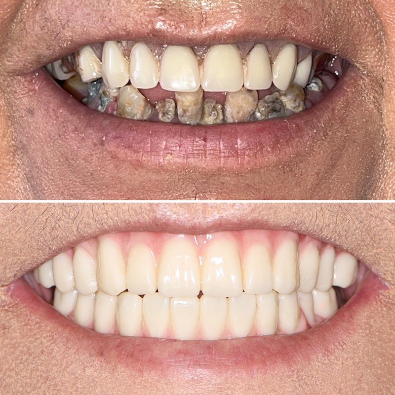 Itani Dental San Francisco: Dentistry to Your Door® photo 3