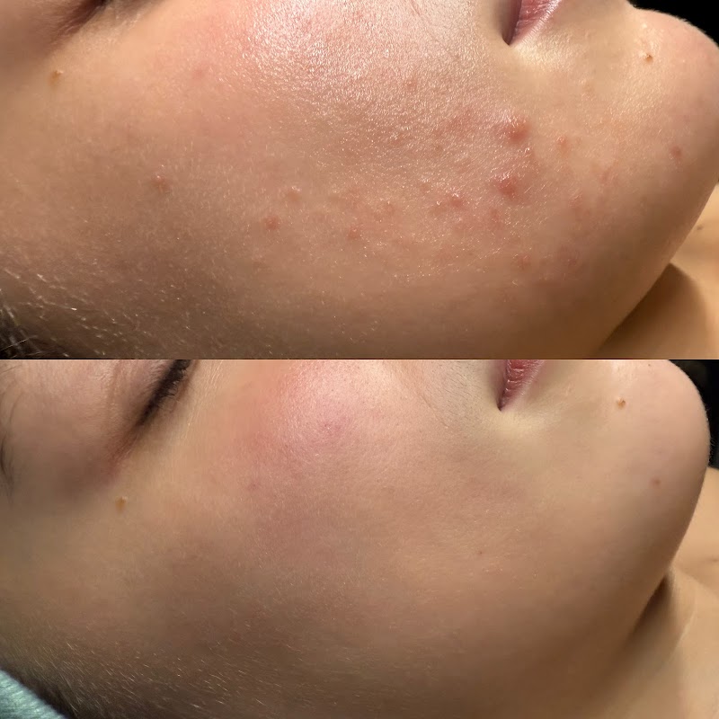 NC Aesthetics Facial Studio photo 4