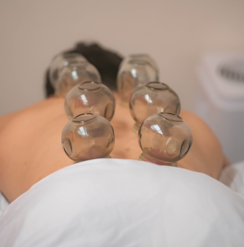 Photo of The Cupping Box