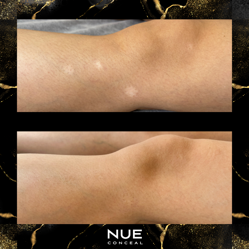 Concealed Esthetics photo 3