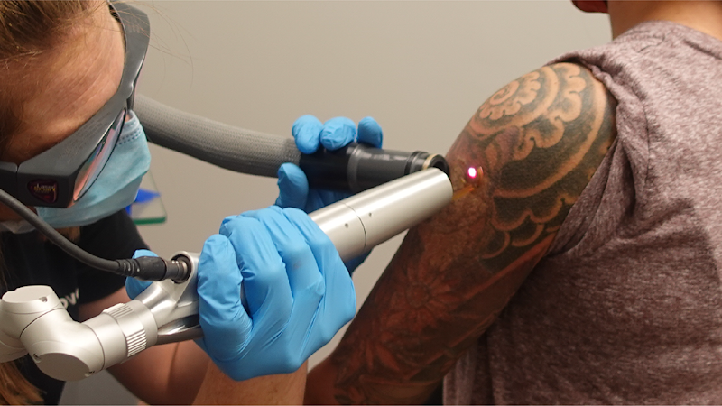 Removery Tattoo Removal & Fading photo 5
